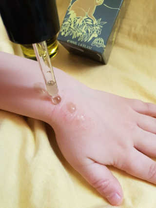 [트리앤씨] 시그니처 리프레쉬 타마누오일 30ml — 4점을 준 리뷰어가 2019년 3월 올린 사용 사진