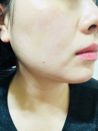23years old 바데카실 오리지널 — 3.17점을 준 리뷰어가 2018년 2월 올린 사용 사진