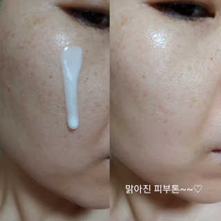 Dr.메디션 본래의 피부로 되돌려주는 리턴미백에센스 — 4점을 준 리뷰어가 2018년 9월 올린 사용 사진