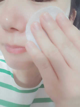 나이팅게일 토닝 필링패드(티트리) — 4점을 준 리뷰어가 2017년 11월 올린 사용 사진