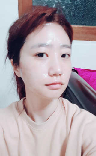 [더마허브] 주사팩 5종, 물광,백옥,태반,신데렐라 등 — 5점을 준 리뷰어가 2018년 3월 올린 사용 사진