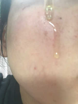 비건화장품 멜릭서 내 피부를 위한 비건케어, 멜릭서 비타민세럼 — 4점을 준 리뷰어가 2019년 3월 올린 사용 사진