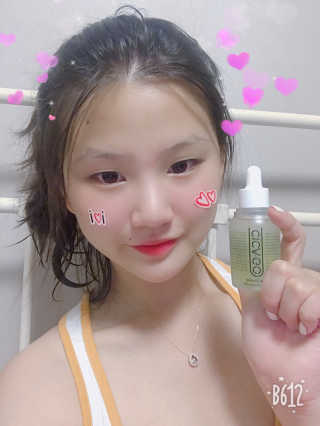 시카고 시카 더블 이펙트 앰플 30ml 기획세트 — 4.67점을 준 리뷰어가 2018년 8월 올린 사용 사진