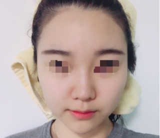 다슈코리아 다슈 데일리 헤어라인 커버 쿠션 — 4.33점을 준 리뷰어가 2017년 4월 올린 사용 사진