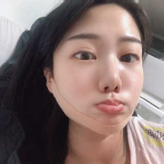 아이디플라코스메틱 아이디 페이스핏 마이너스 밴드 — 5점을 준 리뷰어가 2020년 1월 올린 사용 사진