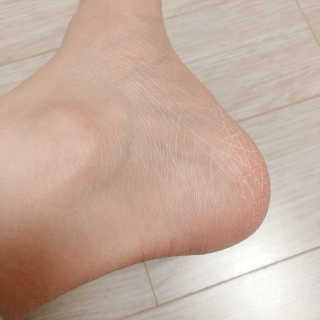 (주)에네스티 에네스티 수안수 실크스킨 풋크림 1+1 — 5점을 준 리뷰어가 2019년 11월 올린 사용 사진