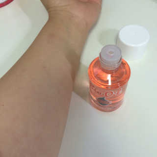 Bio-oil(바이오오일) 바이오오일 — 5점을 준 리뷰어가 2016년 10월 올린 사용 사진