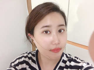 아이디플라코스메틱 아이디 페이스핏 마이너스 밴드 — 5점을 준 리뷰어가 2019년 10월 올린 사용 사진