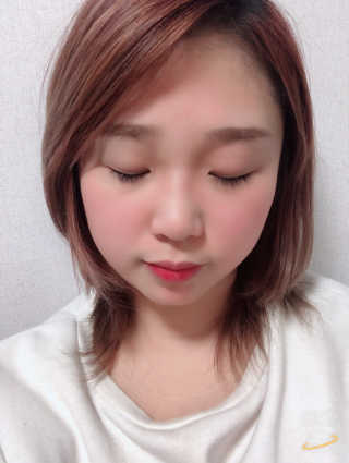 나이팅게일 티타민 크림 리뉴얼 — 5점을 준 리뷰어가 2018년 4월 올린 사용 사진