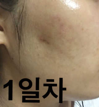 23years old 징크놀시카 — 5점을 준 리뷰어가 2017년 9월 올린 사용 사진