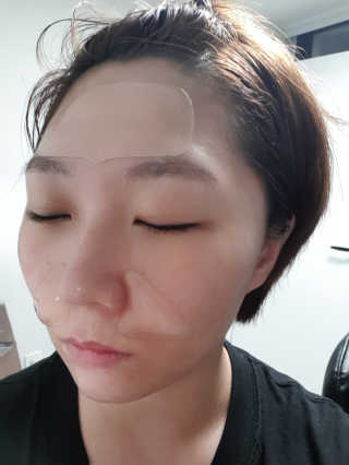 아이디플라코스메틱 아이디 페이스핏 플러스 패치 — 4점을 준 리뷰어가 2019년 10월 올린 사용 사진