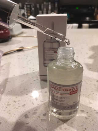 [마녀 공장] 발가락 토미 니아신 에센스 50ml — 5점을 준 리뷰어가 2019년 1월 올린 사용 사진
