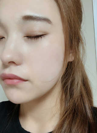 자이엘 S.O.S 레드 칙 케어팩 2 Box — 5점을 준 리뷰어가 2020년 2월 올린 사용 사진