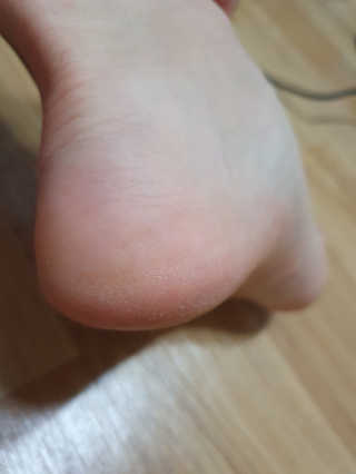 (주)에네스티 에네스티 수안수 실크스킨 풋크림 1+1 — 5점을 준 리뷰어가 2019년 9월 올린 사용 사진