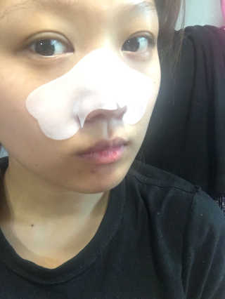 나이팅게일 TAKO PACK NOSE [문어코팩] — 2.17점을 준 리뷰어가 2017년 5월 올린 사용 사진