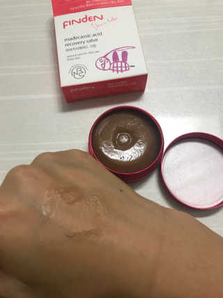 핀덴스킨베베 마데카식애씨드크림 35g — 5점을 준 리뷰어가 2018년 6월 올린 사용 사진