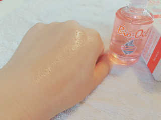 Bio-oil(바이오오일) 바이오오일 — 5점을 준 리뷰어가 2016년 10월 올린 사용 사진