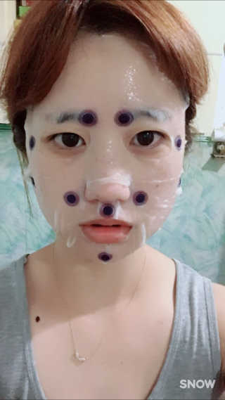 메디힐 바이오포인트 서클포인트마스크 3종 — 4.67점을 준 리뷰어가 2017년 5월 올린 사용 사진