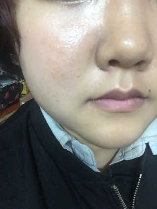 쏘내추럴 커버 픽싱 쿠션 SPF50+/PA+++ — 3.5점을 준 리뷰어가 2016년 10월 올린 사용 사진