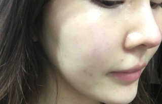 더메이런 에잇콤플렉스 워터드롭 화이트 크림 — 3.5점을 준 리뷰어가 2017년 1월 올린 사용 사진