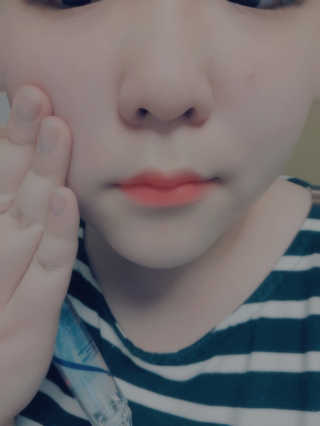 23years old 바데카실 프로 엑스퍼트 앰플 — 5점을 준 리뷰어가 2018년 10월 올린 사용 사진
