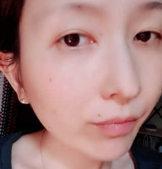 메디타임 멜라반 더마 토닝 씬젤 — 4점을 준 리뷰어가 2019년 6월 올린 사용 사진