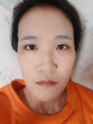보타메디 씨놀®미라클마스크팩 — 3.33점을 준 리뷰어가 2018년 12월 올린 사용 사진