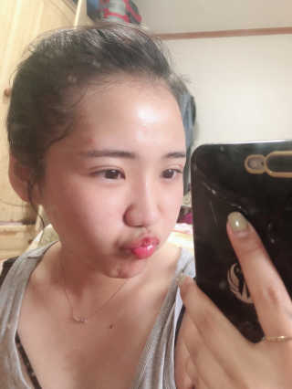 23years old 바데카실 프로 엑스퍼트 앰플 — 5점을 준 리뷰어가 2018년 6월 올린 사용 사진