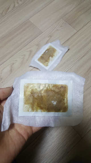 메디테라피 더마 릴렉스 힐링패치 — 5점을 준 리뷰어가 2018년 4월 올린 사용 사진