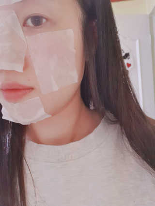 셀리맥스 노니  수분 밸런싱 토너 — 4점을 준 리뷰어가 2020년 2월 올린 사용 사진