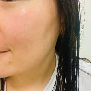 미샤 타임레볼루션 개똥쑥 진정 크림 — 5점을 준 리뷰어가 2020년 1월 올린 사용 사진