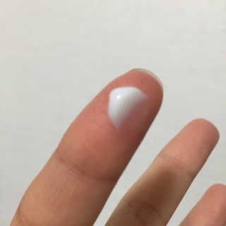 나이팅게일 티타민 크림 리뉴얼 — 5점을 준 리뷰어가 2018년 10월 올린 사용 사진
