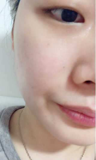 블랙모어스 내츄럴 비타민 E 크림 — 4.5점을 준 리뷰어가 2018년 3월 올린 사용 사진