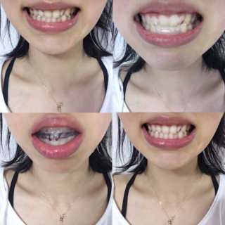 예담님이 올린 리뷰 사진 2