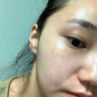 아로마피츠 토닉 유칼립투스[정화토너] — 5점을 준 리뷰어가 2019년 10월 올린 사용 사진
