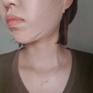 아이디플라코스메틱 아이디 페이스핏 마이너스 밴드 — 5점을 준 리뷰어가 2019년 10월 올린 사용 사진