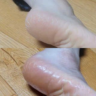 포포님이 올린 리뷰 사진 1