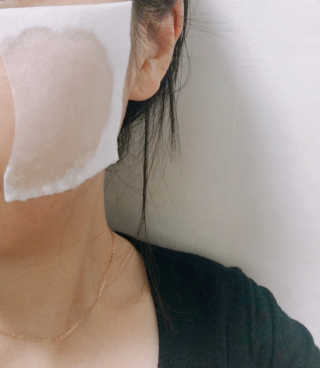 입큰뉴욕 비얼라우 제주 곰솔잎 맑은 에센스 — 3.5점을 준 리뷰어가 2020년 1월 올린 사용 사진