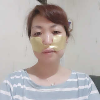 [스케덤] 상악밴드 — 5점을 준 리뷰어가 2019년 6월 올린 사용 사진