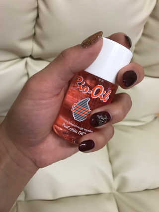 Bio-oil(바이오오일) 바이오오일(Bio-oil) — 5점을 준 리뷰어가 2016년 12월 올린 사용 사진