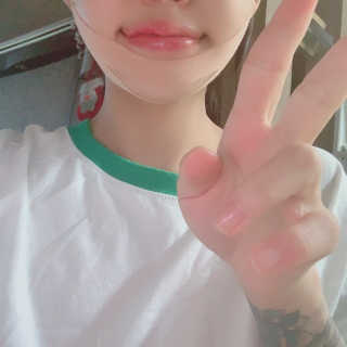 아이디플라코스메틱 아이디 페이스핏 마이너스 밴드 — 4.5점을 준 리뷰어가 2019년 9월 올린 사용 사진