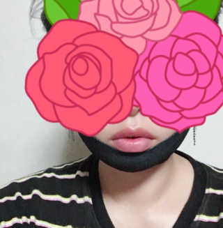어웨이크어슬립 어슬립 페이스 리프트업 밴드 — 5점을 준 리뷰어가 2018년 5월 올린 사용 사진
