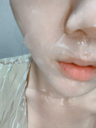 타이니케어 시카 더마 마스크 — 5점을 준 리뷰어가 2019년 10월 올린 사용 사진