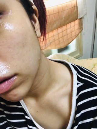 타임인네이처 [더메디닥터] 카렌듈라 엔자임 필링젤 — 5점을 준 리뷰어가 2019년 4월 올린 사용 사진