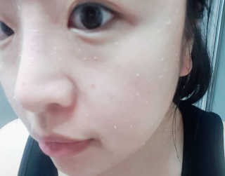 타임인네이처 [더메디닥터] 카렌듈라 엔자임 필링젤 — 5점을 준 리뷰어가 2019년 4월 올린 사용 사진