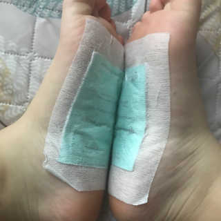 메디테라피 더마 릴렉스 힐링패치 — 3.33점을 준 리뷰어가 2018년 3월 올린 사용 사진