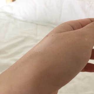 dr.eslee 안티세범 백크네 스프레이 — 5점을 준 리뷰어가 2019년 5월 올린 사용 사진
