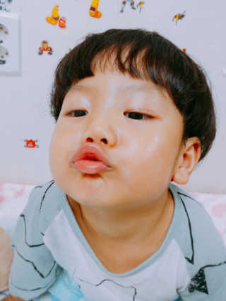 아토베네 수딩 앤 나이트 밤 25g — 4.5점을 준 리뷰어가 2016년 11월 올린 사용 사진