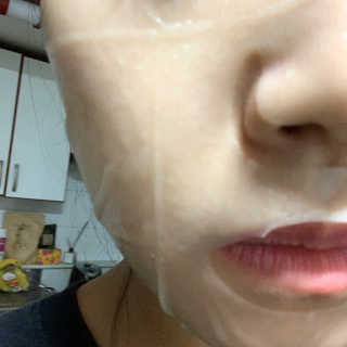 웰더마 차 이슬 티트리 수딩 앰플 마스크 — 5점을 준 리뷰어가 2019년 12월 올린 사용 사진
