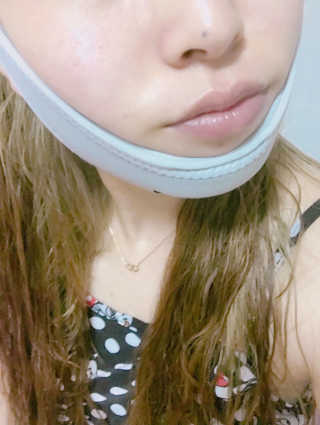 메디미 브이미 업 2스텝 브이라인벨트 — 3.5점을 준 리뷰어가 2017년 9월 올린 사용 사진